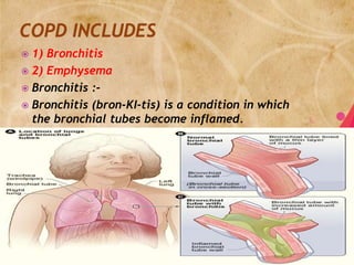  1) Bronchitis
 2) Emphysema
 Bronchitis :-
 Bronchitis (bron-KI-tis) is a condition in which
  the bronchial tubes become inflamed.
 