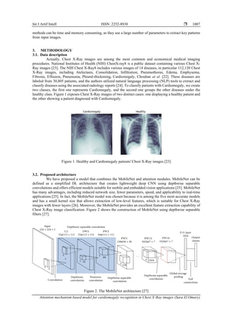 Int J Artif Intell ISSN: 2252-8938 
Attention mechanism based model for cardiomegaly recognition in Chest X-Ray images (Sara El Omary)
1007
methods can be time and memory consuming, as they use a large number of parameters to extract key patterns
from input images.
3. METHODOLOGY
3.1. Data description
Actually, Chest X-Ray images are among the most common and economical medical imaging
procedures. National Institutes of Health (NIH) ChestX-ray8 is a public dataset containing various Chest X-
Ray images [23]. The NIH Chest X-Ray8 includes various images of 14 diseases, in particular 112,120 Chest
X-Ray images, including Atelectasis, Consolidation, Infiltration, Pneumothorax, Edema, Emphysema,
Fibrosis, Effusion, Pneumonia, Pleural-thickening, Cardiomegaly, Chouhan at al. [22]. These diseases are
labeled from 30,805 patients, and the authors utilized natural language processing (NLP) tools to extract and
classify diseases using the associated radiology reports [24]. To classify patients with Cardiomegaly, we create
two classes, the first one represents Cardiomegaly, and the second one groups the other diseases under the
healthy class. Figure 1 exposes Chest X-Ray images of two distinct cases: one displaying a healthy patient and
the other showing a patient diagnosed with Cardiomegaly.
Figure 1. Healthy and Cardiomegaly patients' Chest X-Ray images [23]
3.2. Proposed architecture
We have proposed a model that combines the MobileNet and attention modules. MobileNet can be
defined as a simplified DL architecture that creates lightweight deep CNN using depthwise separable
convolutions and offers efficient models suitable for mobile and embedded vision applications [25]. MobileNet
has many advantages, including reduced network size, fewer parameters, speed, and applicability to real-time
applications [25]. In fact, the MobileNet model was chosen because it is among the five most accurate models
and has a small kernel size that allows extraction of low-level features, which is suitable for Chest X-Ray
images with fewer layers [26]. Moreover, the MobileNet provides an excellent feature extraction capability of
Chest X-Ray image classification. Figure 2 shows the construction of MobileNet using depthwise separable
filters [27].
Figure 2. The MobileNet architecture [27]
 