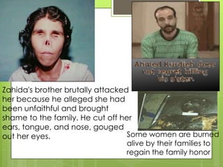 Zahida's brother brutally attacked
her because he alleged she had
been unfaithful and brought
shame to the family. He cut off her
ears, tongue, and nose, gouged
out her eyes.                     Some women are burned
                                  alive by their families to
                                  regain the family honor
 