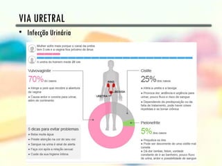 VIA URETRAL
• Infecção Urinária
 