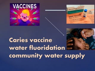 Caries vaccine
water fluoridation –
community water supply
 