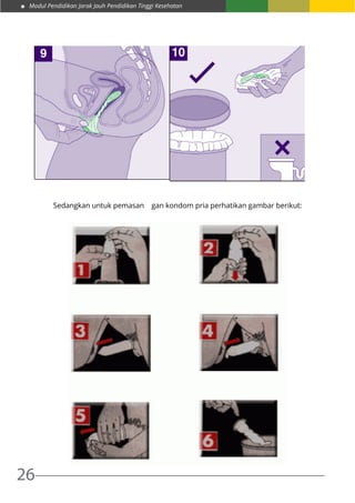 Modul Pendidikan Jarak Jauh Pendidikan Tinggi Kesehatan
26
Sedangkan untuk pemasan gan kondom pria perhatikan gambar berikut:
 