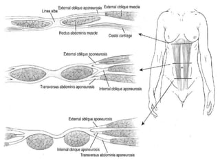 Abdominal wall anatomy 