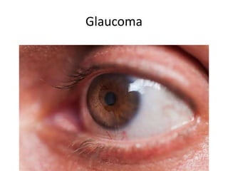 Glaucoma
 