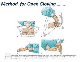 Method for Open Gloving …….. 
 