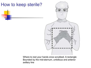 How to keep sterile? 
Where to rest your hands once scrubbed. A rectangle 
Bounded by the mid-sternum, umbilicus and anterior 
axillary line 
 