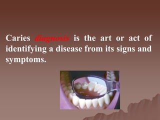 Caries diagnosis is the art or act of
identifying a disease from its signs and
symptoms.
 