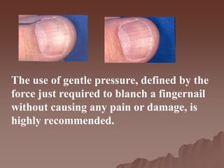 The use of gentle pressure, defined by the
force just required to blanch a fingernail
without causing any pain or damage, is
highly recommended.
 