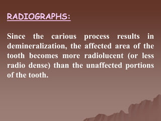 RADIOGRAPHS:
Since the carious process results in
demineralization, the affected area of the
tooth becomes more radiolucent (or less
radio dense) than the unaffected portions
of the tooth.
 