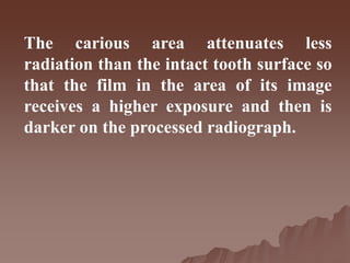 The carious area attenuates less
radiation than the intact tooth surface so
that the film in the area of its image
receives a higher exposure and then is
darker on the processed radiograph.
 