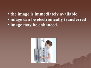 • the image is immediately available
• image can be electronically transferred
• image may be enhanced.
 