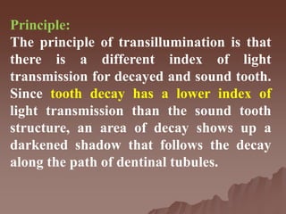 Principle:
The principle of transillumination is that
there is a different index of light
transmission for decayed and sound tooth.
Since tooth decay has a lower index of
light transmission than the sound tooth
structure, an area of decay shows up a
darkened shadow that follows the decay
along the path of dentinal tubules.
 