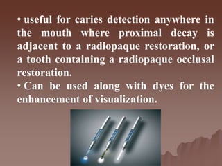 • useful for caries detection anywhere in
the mouth where proximal decay is
adjacent to a radiopaque restoration, or
a tooth containing a radiopaque occlusal
restoration.
• Can be used along with dyes for the
enhancement of visualization.
 