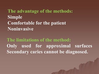 The advantage of the methods:
Simple
Comfortable for the patient
Noninvasive
The limitations of the method:
Only used for approximal surfaces
Secondary caries cannot be diagnosed.
 