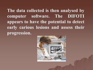 The data collected is then analysed by
computer software. The DIFOTI
appears to have the potential to detect
early carious lesions and assess their
progression.
 