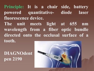 Principle: It is a chair side, battery
powered quantitative- diode laser
fluorescence device.
The unit meets light at 655 nm
wavelength from a fiber optic bundle
directed onto the occlusal surface of a
tooth.
DIAGNOdent
pen 2190
 