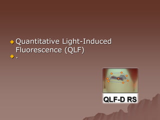  .
 Quantitative Light-Induced
Fluorescence (QLF)
 