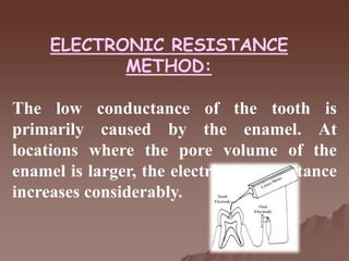 ELECTRONIC RESISTANCE
METHOD:
The low conductance of the tooth is
primarily caused by the enamel. At
locations where the pore volume of the
enamel is larger, the electrical conductance
increases considerably.
 