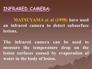 INFRARED CAMERA:
MATSUYAMA et al (1998) have used
an infrared camera to detect subsurface
lesions.
The infrared camera can be used to
measure the temperature drop on the
lesion surfaces caused by evaporation of
water in the body of lesion.
 