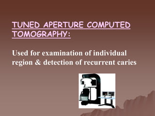 TUNED APERTURE COMPUTED
TOMOGRAPHY:
Used for examination of individual
region & detection of recurrent caries
 