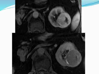 Casos de abdomen