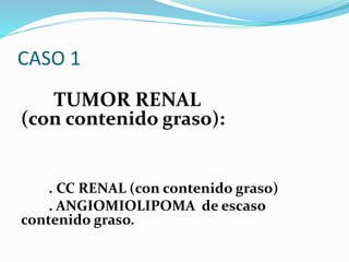 CASO 1
TUMOR RENAL
(con contenido graso):
. CC RENAL (con contenido graso)
. ANGIOMIOLIPOMA de escaso
contenido graso.
 