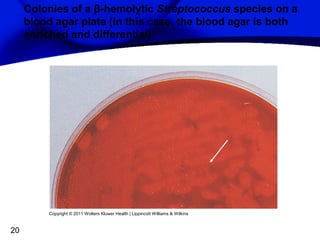 Colonies of a β-hemolytic Streptococcus species on a
blood agar plate (in this case, the blood agar is both
enriched and differential)

Copyright © 2011 Wolters Kluwer Health | Lippincott Williams & Wilkins

20

 