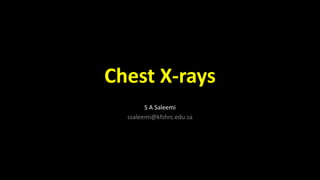 Chest X-rays
S A Saleemi
ssaleemi@kfshrc.edu.sa
 