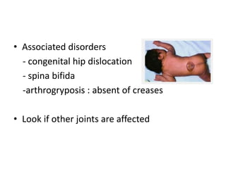 • Associated disorders
- congenital hip dislocation
- spina bifida
-arthrogryposis : absent of creases
• Look if other joints are affected
 