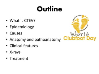 Outline
• What is CTEV?
• Epidemiology
• Causes
• Anatomy and pathoanatomy
• Clinical features
• X-rays
• Treatment
 