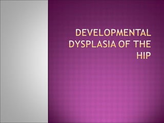 Developmental dysplasiahip