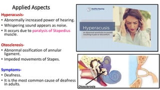 Applied Aspects
Hyperacusis-
• Abnormally increased power of hearing.
• Whispering sound appears as noise.
• It occurs due to paralysis of Stapedius
muscle.
Otosclerosis-
• Abnormal ossification of annular
ligament.
• Impeded movements of Stapes.
Symptoms-
• Deafness.
• It is the most common cause of deafness
in adults.
 