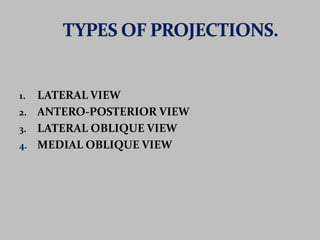 1. LATERAL VIEW 
2. ANTERO-POSTERIOR VIEW 
3. LATERAL OBLIQUE VIEW 
4. MEDIAL OBLIQUE VIEW 
 