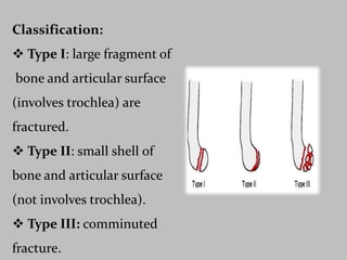 Classification: 
 Type I: large fragment of 
bone and articular surface 
(involves trochlea) are 
fractured. 
 Type II: small shell of 
bone and articular surface 
(not involves trochlea). 
 Type III: comminuted 
fracture. 
 