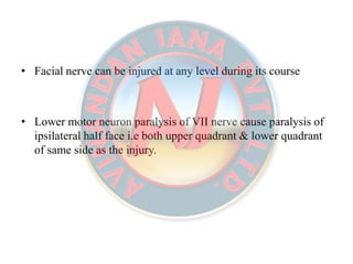 • Facial nerve can be injured at any level during its course
• Lower motor neuron paralysis of VII nerve cause paralysis of
ipsilateral half face i.e both upper quadrant & lower quadrant
of same side as the injury.
 