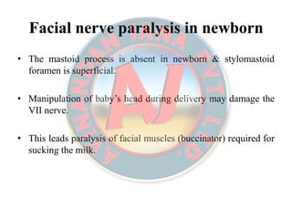 Facial nerve paralysis in newbornFacial nerve paralysis in newborn
• The mastoid process is absent in newborn & stylomastoid
foramen is superficial.
• Manipulation of baby’s head during delivery may damage the
VII nerve.
• This leads paralysis of facial muscles (buccinator) required for
sucking the milk.
 