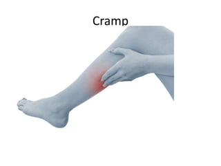 Cramp
 