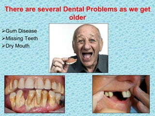 There are several Dental Problems as we get
older
Gum Disease
Missing Teeth
Dry Mouth
 