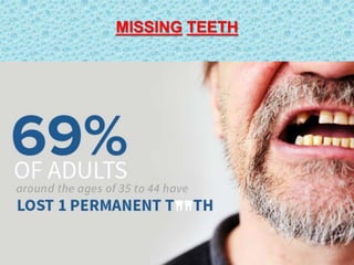 MISSING TEETH
 