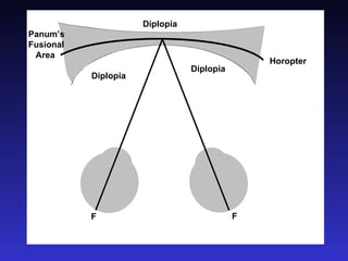 F F Horopter Panum’s  Fusional Area Diplopia Diplopia Diplopia 