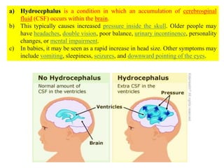 a) Hydrocephalus is a condition in which an accumulation of cerebrospinal
fluid (CSF) occurs within the brain.
b) This typically causes increased pressure inside the skull. Older people may
have headaches, double vision, poor balance, urinary incontinence, personality
changes, or mental impairment.
c) In babies, it may be seen as a rapid increase in head size. Other symptoms may
include vomiting, sleepiness, seizures, and downward pointing of the eyes.
 