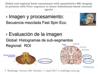  Imagen y procesamiento:
Secuencia mezclada Fast Spin Eco.
 Evaluación de la imagen
Global: Histogramas de sub-segmentos
Regional: ROI
Radiology: Volume 283: Number 1—April 2017 n radiology.rsna.org
Global and regional brain assessment with quantitative MR imaging
in patients with Prior exposure to linear Gadolinium-based contrast
agents
Globo pálido.
*Protuberancia
 