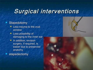 Surgical interventionsSurgical interventions
 StapedotomyStapedotomy
 Less trauma to the ovalLess trauma to the oval
windowwindow
 Less possibility ofLess possibility of
damaging to the inner eardamaging to the inner ear
 In addition, revisionIn addition, revision
surgery, if required, issurgery, if required, is
easier due to preservedeasier due to preserved
anatomyanatomy
 stapedectomystapedectomy
 