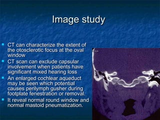 Image studyImage study
 CT can characterize the extent ofCT can characterize the extent of
the otosclerotic focus at the ovalthe otosclerotic focus at the oval
windowwindow
 CT scan can exclude capsularCT scan can exclude capsular
involvement when patients haveinvolvement when patients have
significant mixed hearing losssignificant mixed hearing loss
 An enlarged cochlear aqueductAn enlarged cochlear aqueduct
may be seen which potentialmay be seen which potential
causes perilymph gusher duringcauses perilymph gusher during
footplate fenestration or removal.footplate fenestration or removal.
 It reveal normal round window andIt reveal normal round window and
normal mastoid pneumatization.normal mastoid pneumatization.
 