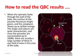 How to read the QBC results ….
• When the operator looks
  through the wall of the
  tube, the nucleus of the
  parasite fluoresces bright
  green, and the cytoplasm
  shows up as yellow-orange.
  The shape and colours are
  quite characteristic, and
  since the parasites are
  concentrated up to
  1000X, there are usually a
  large number of them in
  any field of view in this area
  of the tube.


12/10/2012                    Dr.T.V.Rao MD   41
 