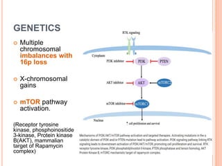 GENETICS
 Multiple
chromosomal
imbalances with
16p loss
 X-chromosomal
gains
 mTOR pathway
activation.
(Receptor tyrosine
kinase, phosphoinositide
3-kinase, Protein kinase
B(AKT), mammalian
target of Rapamycin
complex)
 