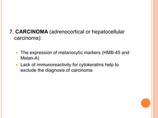 7. CARCINOMA (adrenocortical or hepatocellular
carcinoma):
 The expression of melanocytic markers (HMB-45 and
Melan-A)
 Lack of immunoreactivity for cytokeratins help to
exclude the diagnosis of carcinoma
 