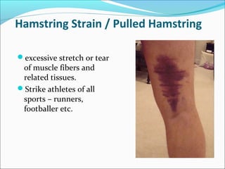 Hamstring Strain / Pulled Hamstring
excessive stretch or tear
of muscle fibers and
related tissues.
Strike athletes of all
sports – runners,
footballer etc.
 