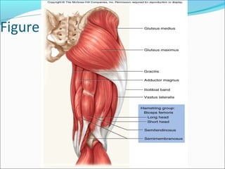 Figure 10.32
 