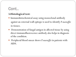 Cont..
3.Histological test:
 Immunohistochemical assay using monoclonal antibody
against an external wall epitope is used to identify P.marneffei
in tissues.
 Demonstration of fungal antigen in affected tissue by using
direct immunofluorescence antibody also helps in diagnosis
of the condition.
 Peripheral blood smear shows P.marneffei in patients with
AIDS.
 